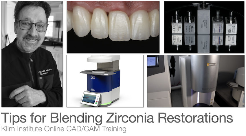 Zirconia Crowns