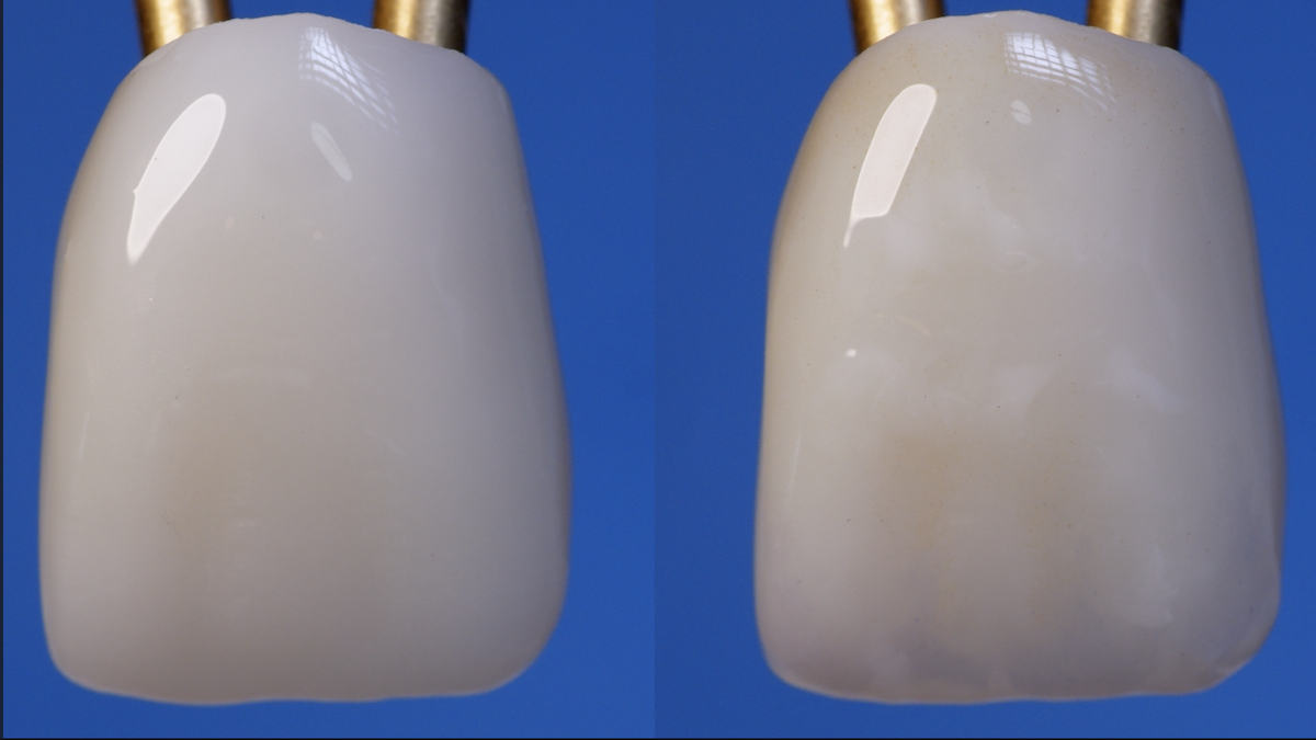 MiYO Esthetic on Zirconia