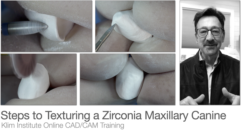 Texturing Anterior Zirconia Restorations