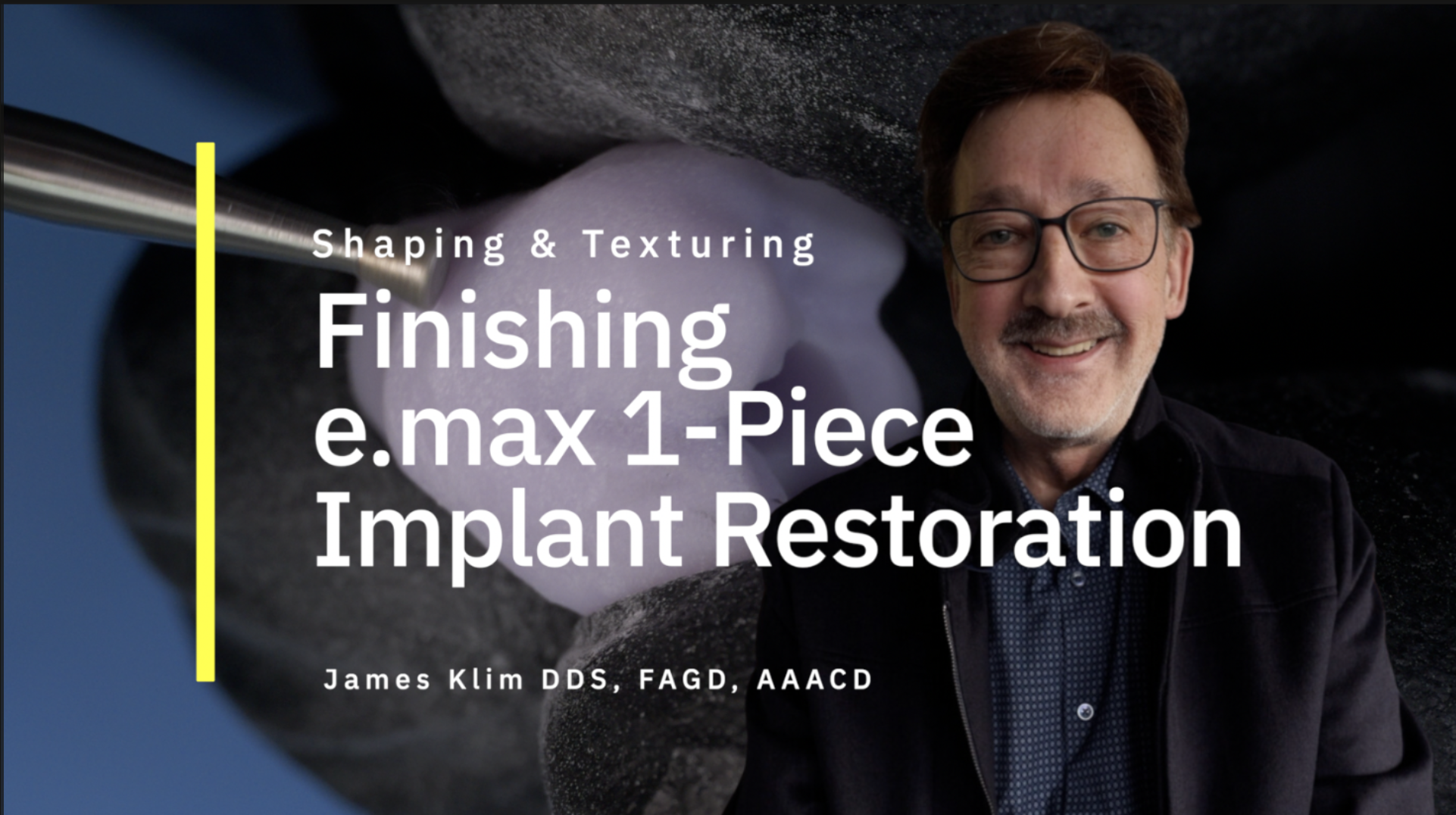 e.max One-Piece Implant Crown Restoration