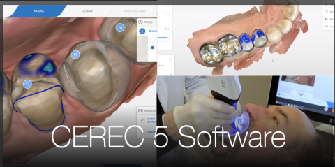 cerec tessera vs emax